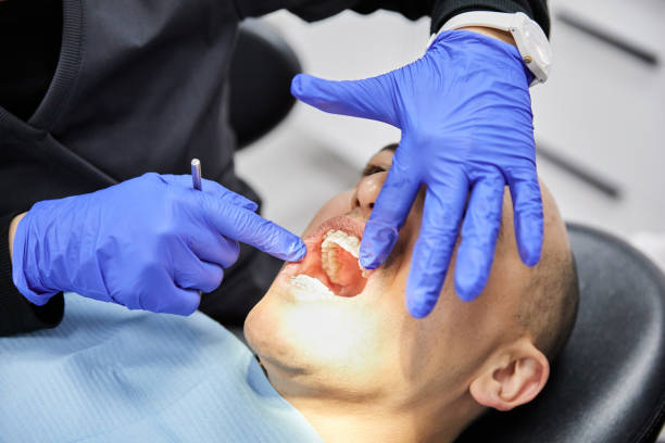 Best Emergency Tooth Extraction in Hillsborough, CA