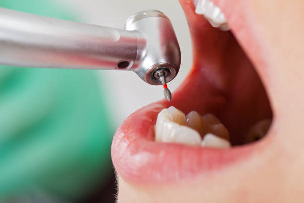 Best Emergency Treatment for Toothache in Hillsborough, CA
